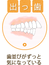 前歯が出ている
